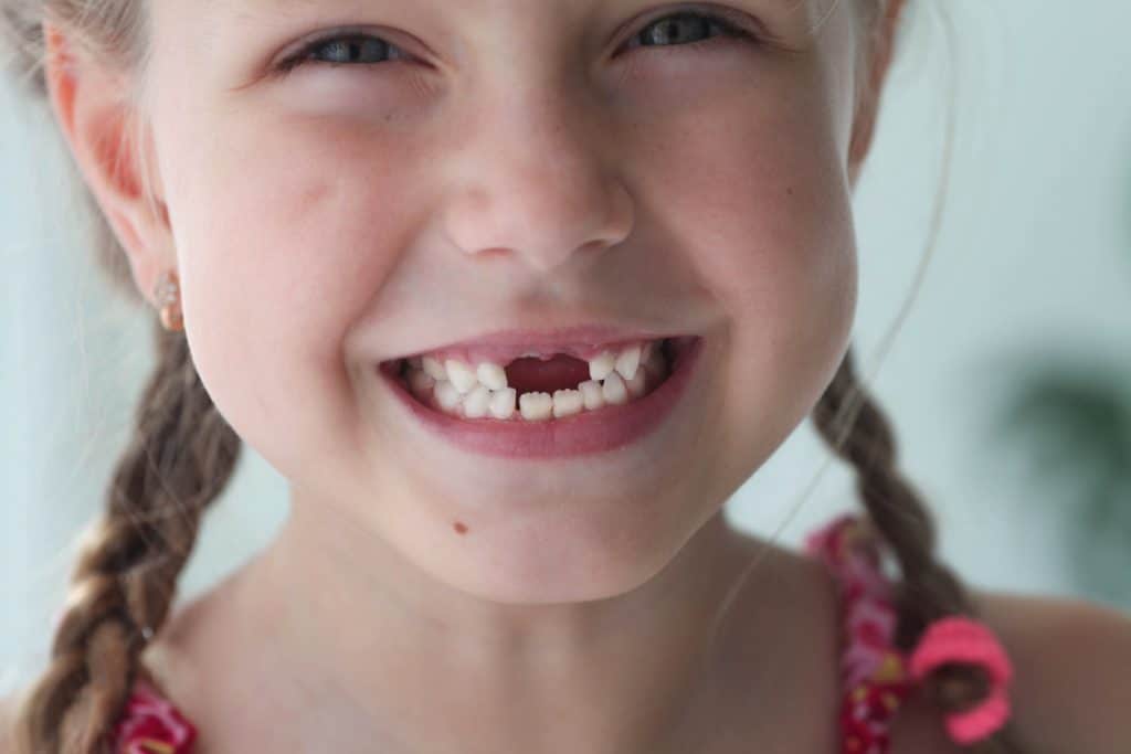 menina sorrindo sem dente