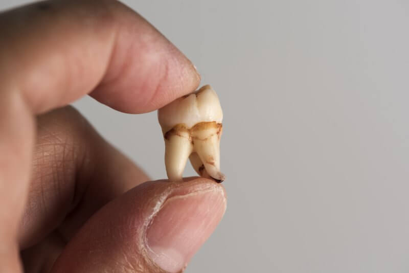 dente na mão da pessoa