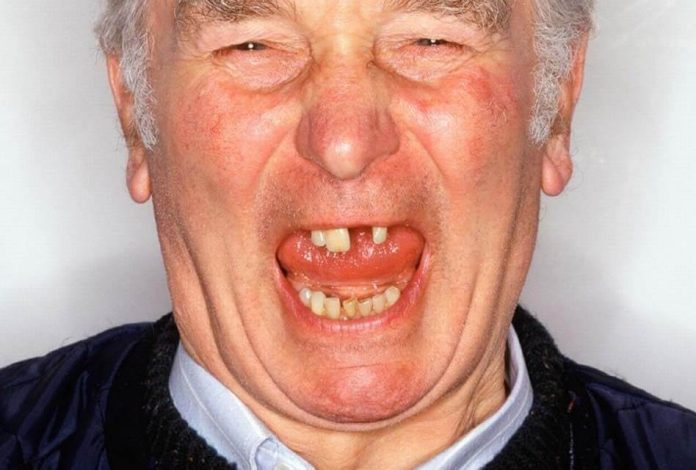 homem velho com dentes moles caindo